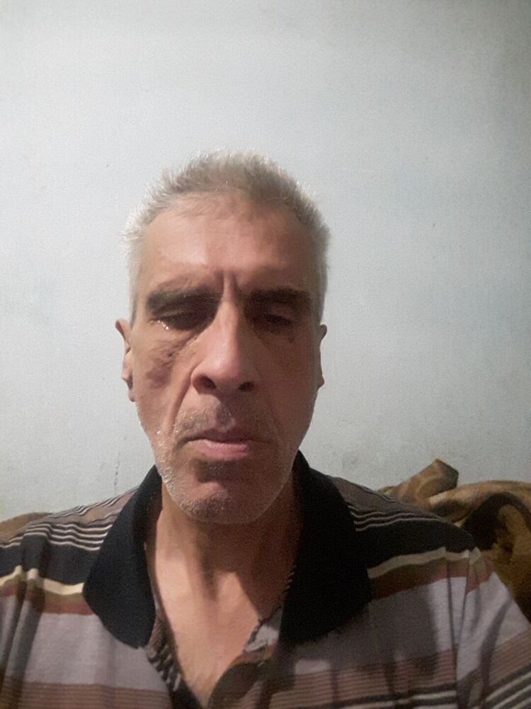  30162738  , 57 ,    