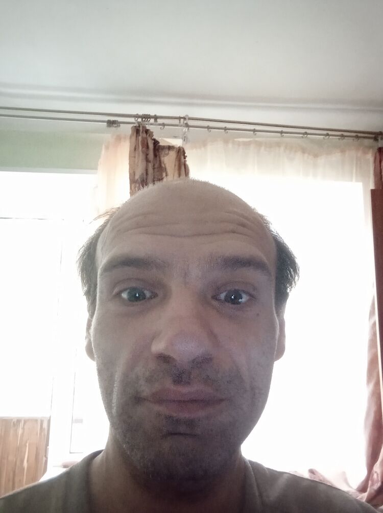  44339058  , 38 ,     