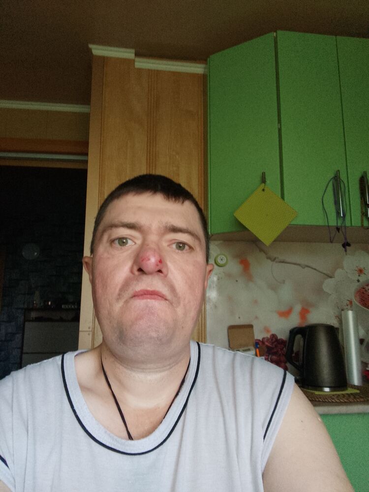  36426768  Itrembach, 47 ,    --