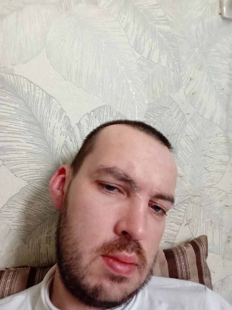 ���� 45172308 ������� ���������, 35 ���, ���� ���������� � ������