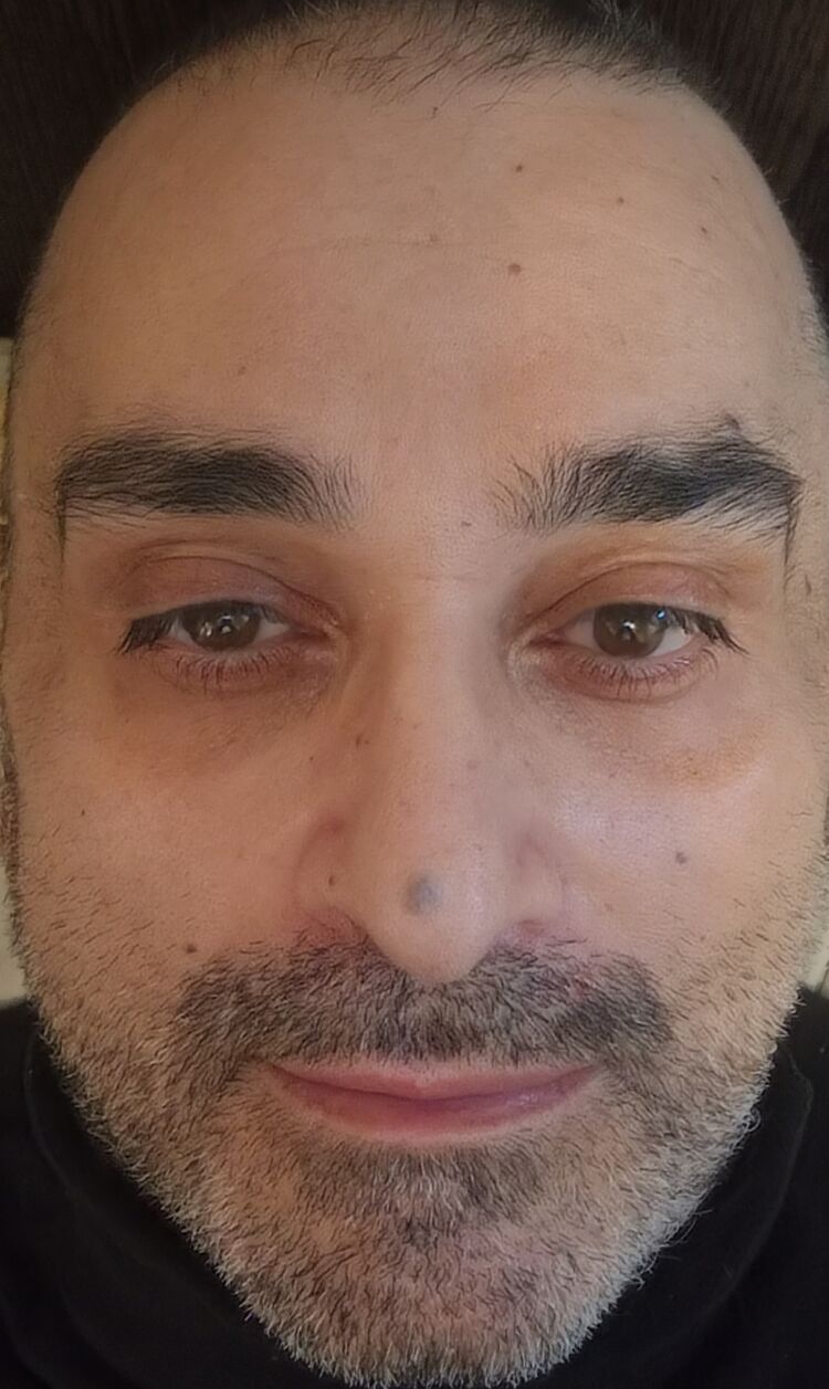 ���������� �����-���������, ���� ������� �����, 53 ����, ������������ 