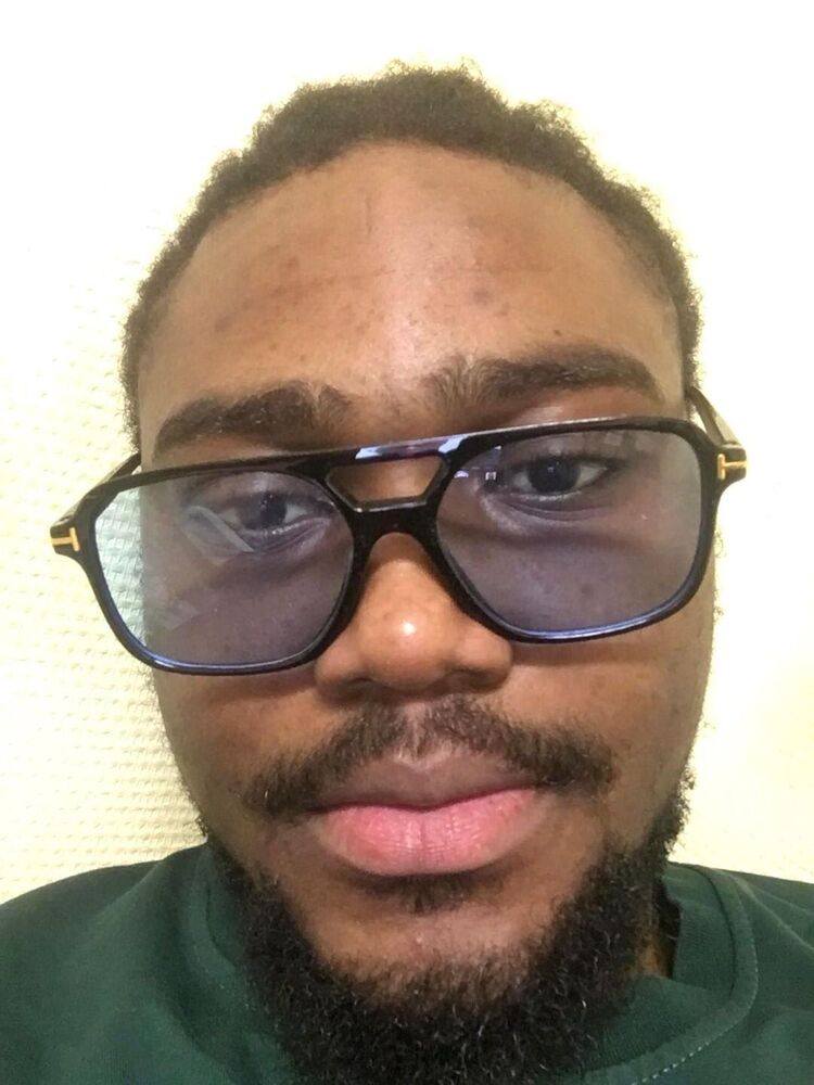  54659628  Glodi, 25 ,    