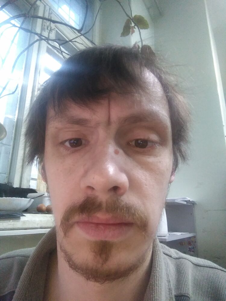  47566738  , 35 ,    