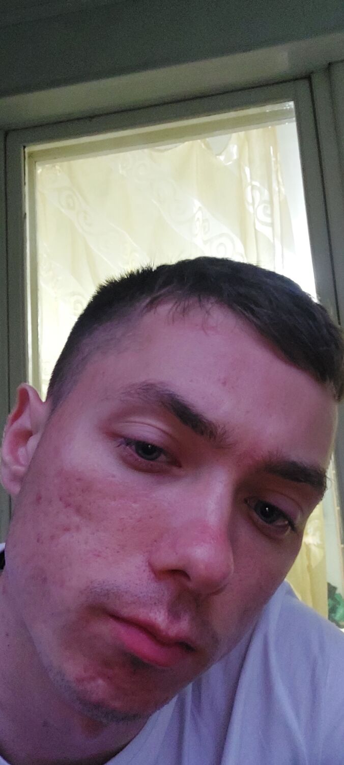  31737798  , 24 ,    