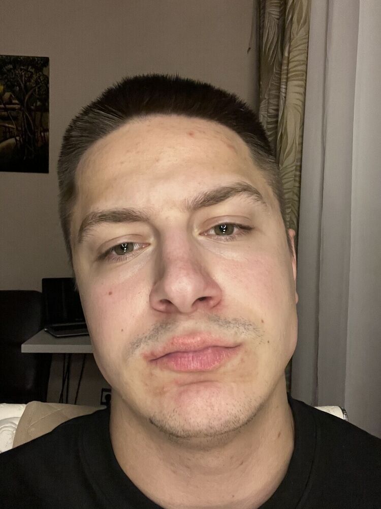  -,   , 35 ,   ,   
