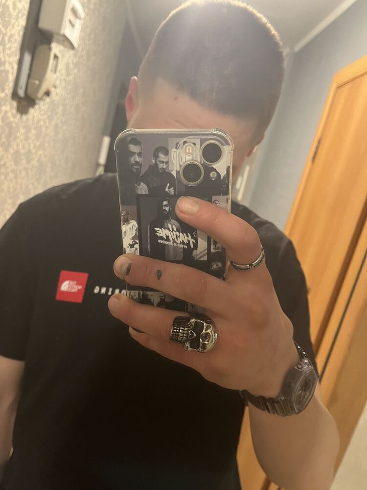  44271308  , 33 ,    --