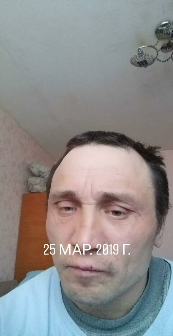 15824308  , 48 ,    