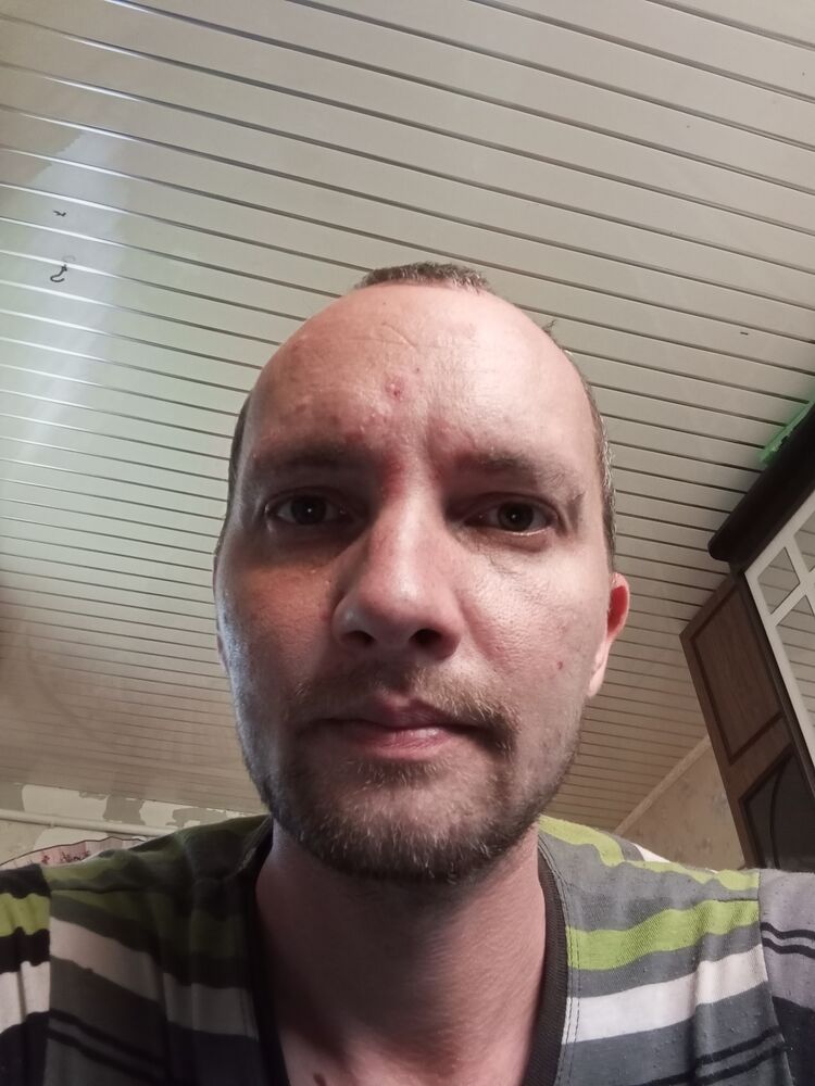  51638238  , 35 ,    