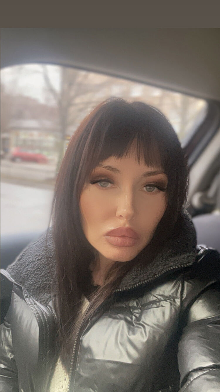  32309228  , 45 ,    --