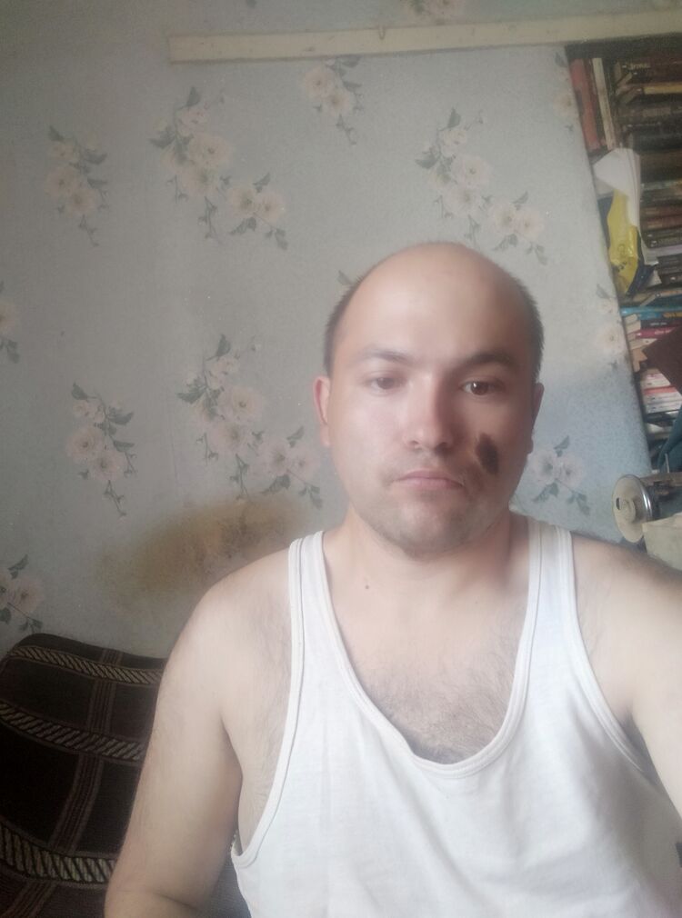  28102928  , 36 ,    
