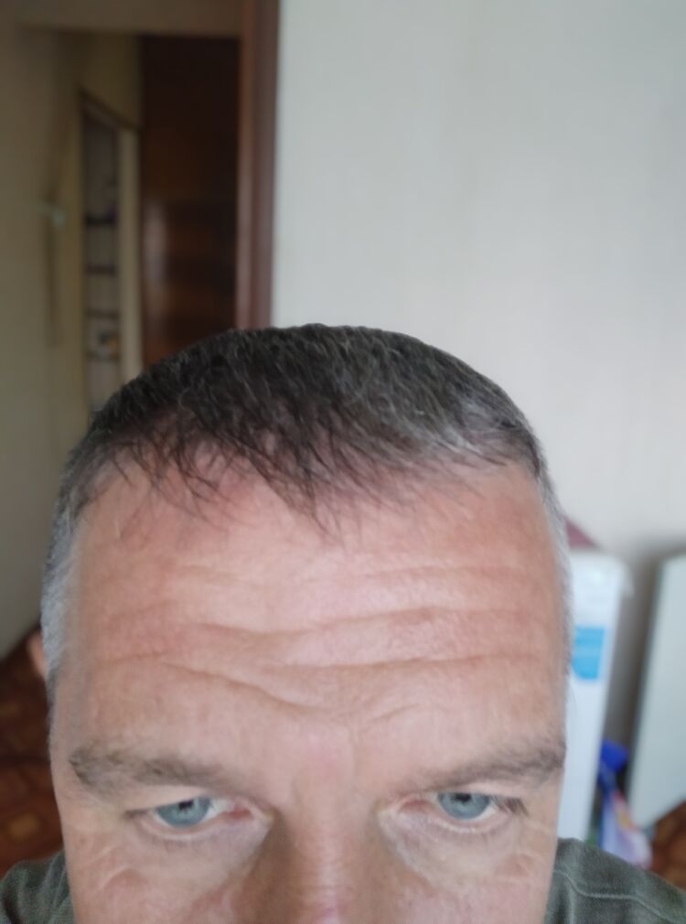  35910888  , 47 ,    