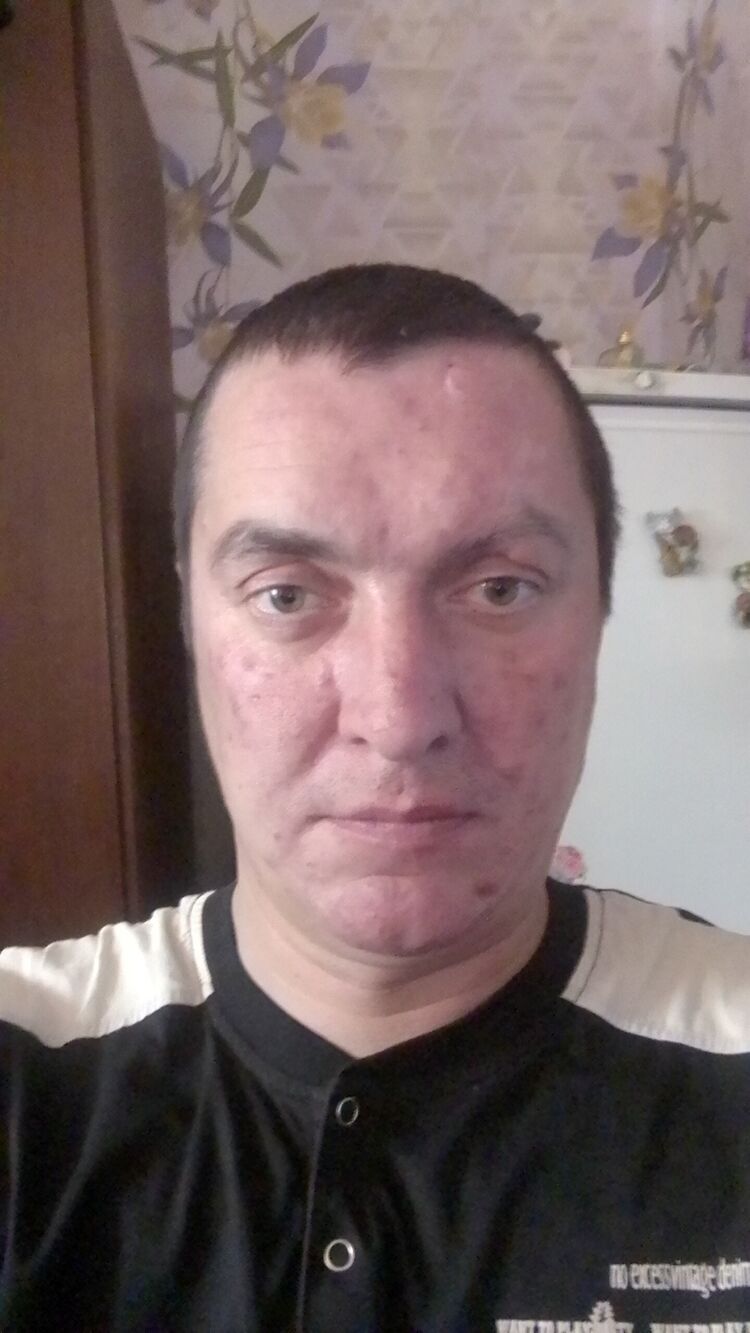  40432298  , 36 ,    