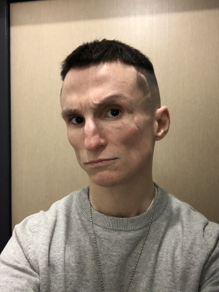  -,   , 33 ,   ,   