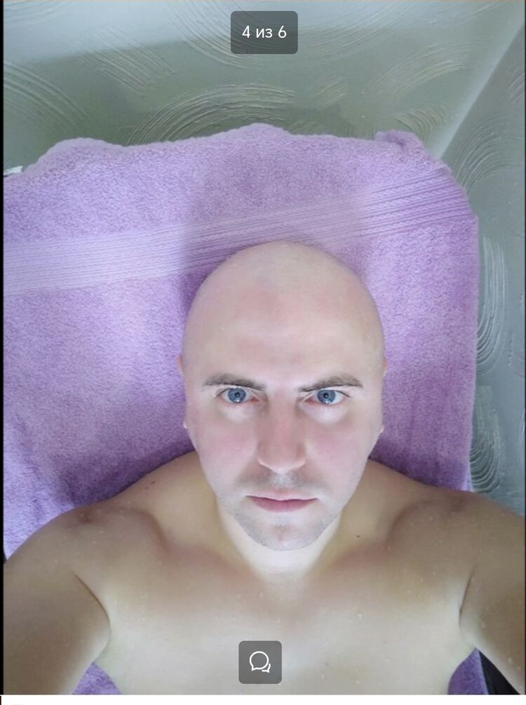  36635028  , 49 ,    