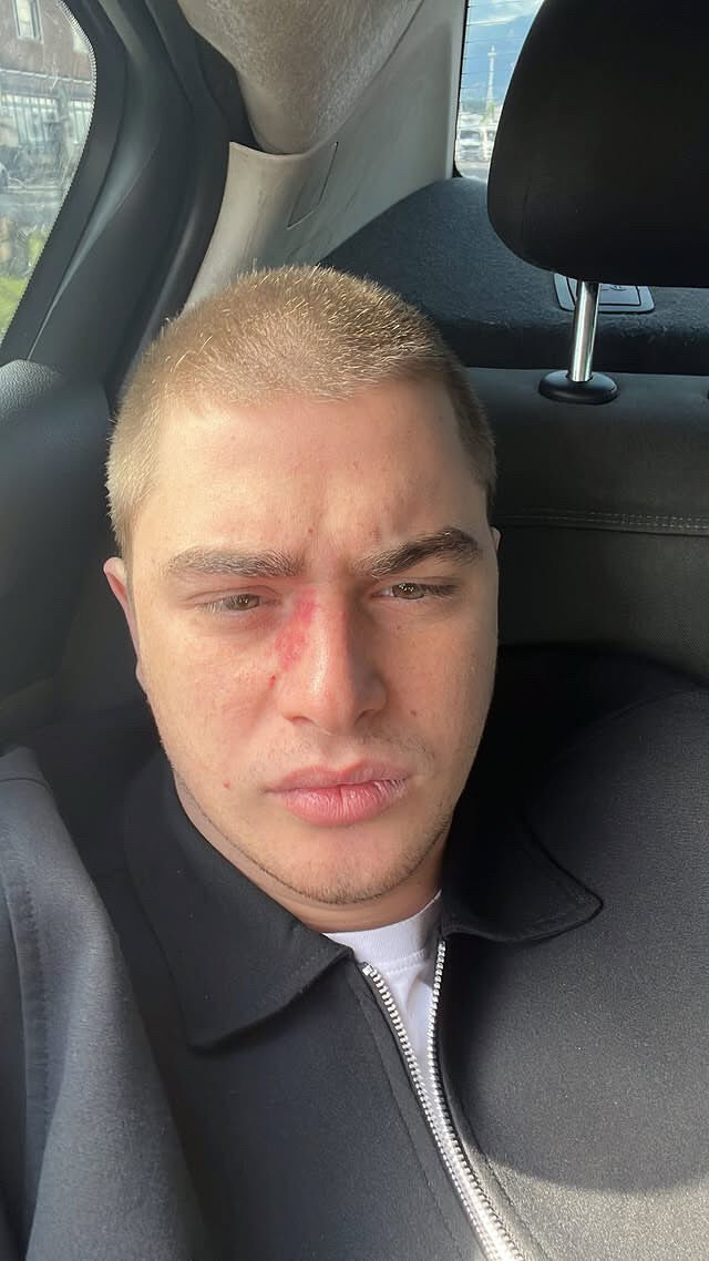  54523048  Niko, 20 ,    