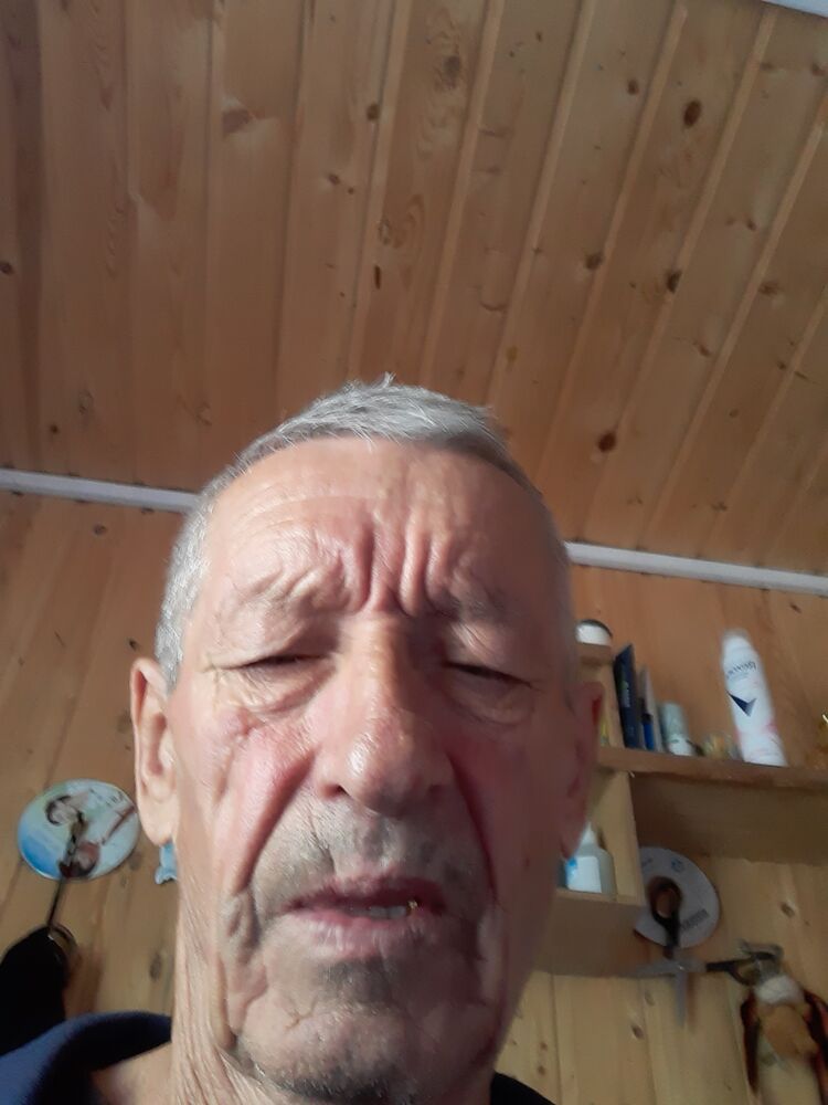  34927628  , 69 ,    