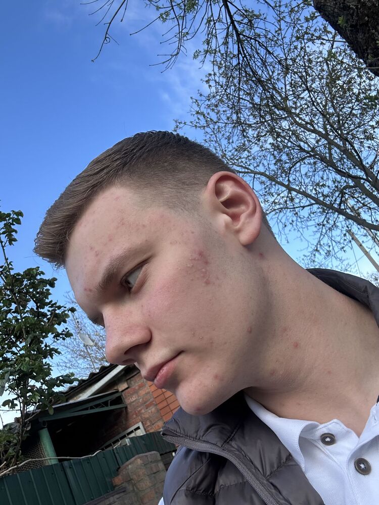  --,   , 18 ,   ,   