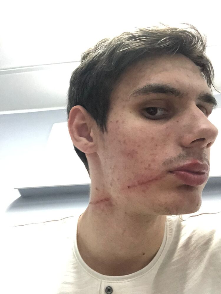 ���������� ����������, ���� ������� ����, 35 ���, ������������ ��� ������, ����� � ���������