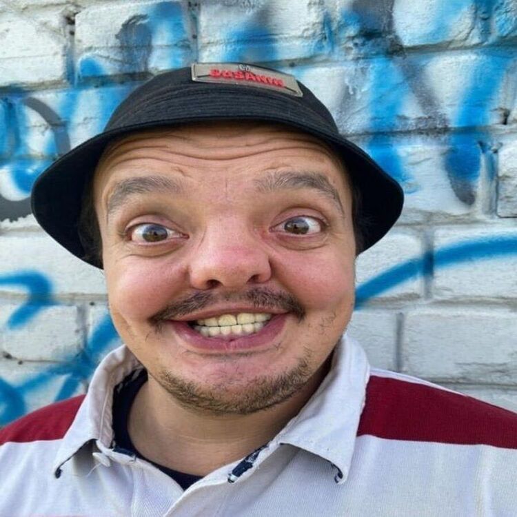  32452738   , 35 ,    