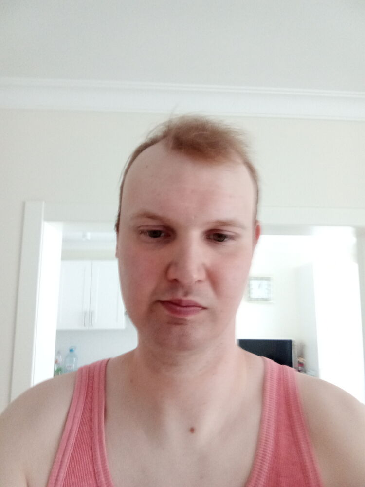  44447758  , 32 ,    -