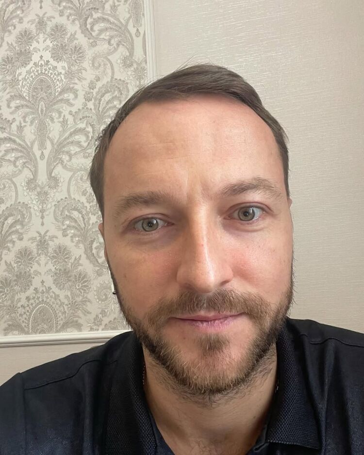 ���� 50745908 ������� �������, 35 ���, ���� ���������� � ���������