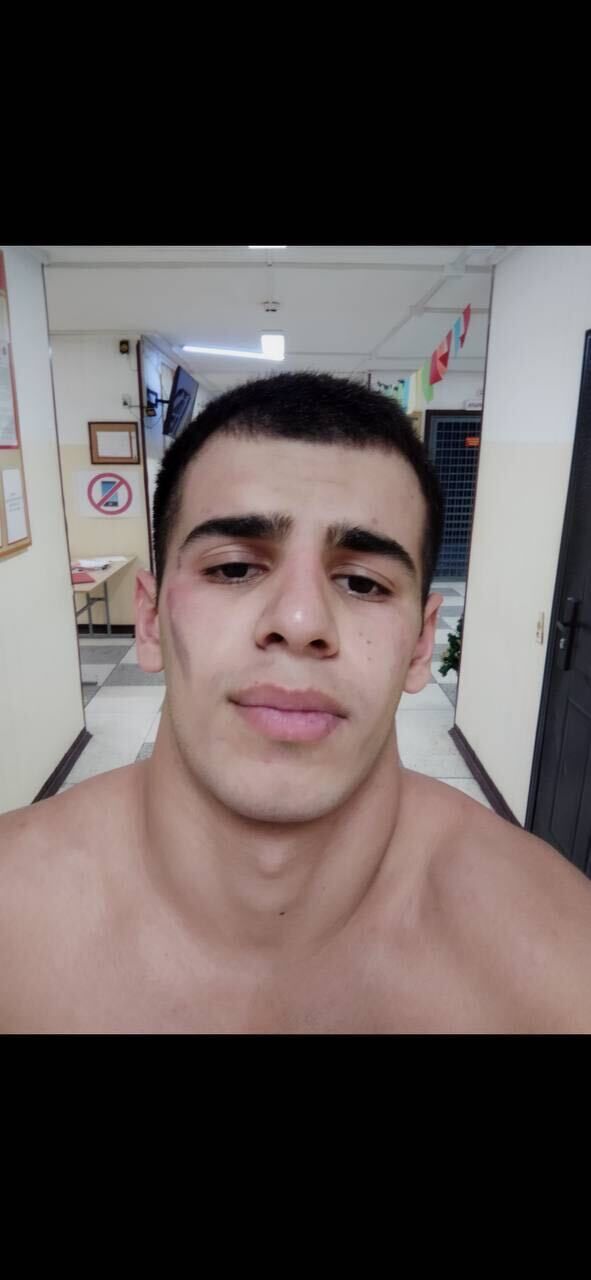  47426398   , 24 ,    