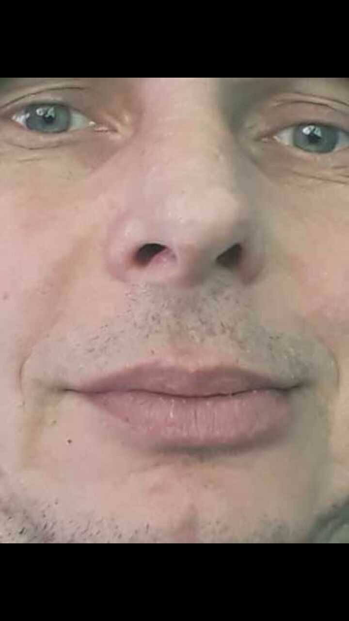  23794068  , 48 ,    