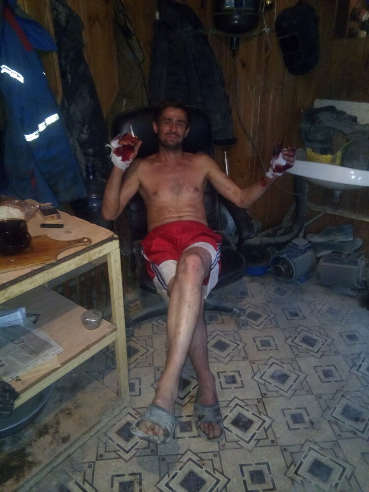  44364348  , 47 ,    