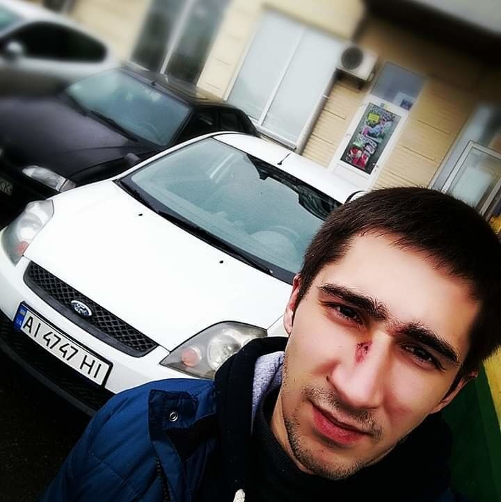 18616228  , 32 ,    