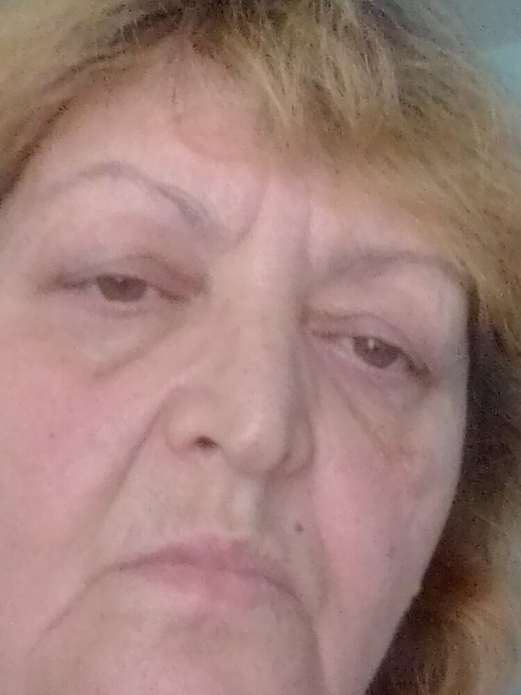  35773708  , 66 ,    