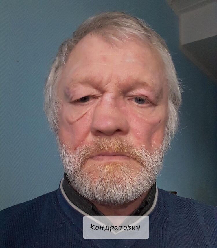 ���� 17510998 ������� ���������, 62 ����, ���� ���������� � ������