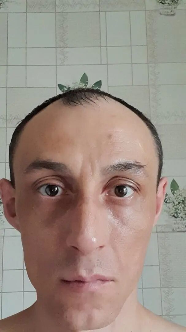  29477218  , 21 ,    