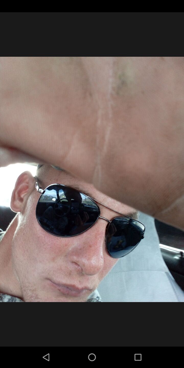  31849578  , 32 ,    