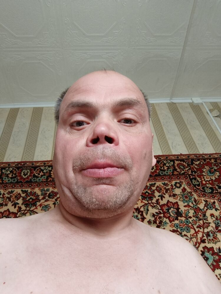  34778318  , 51 ,    