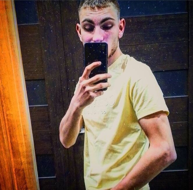  31781918  , 23 ,    