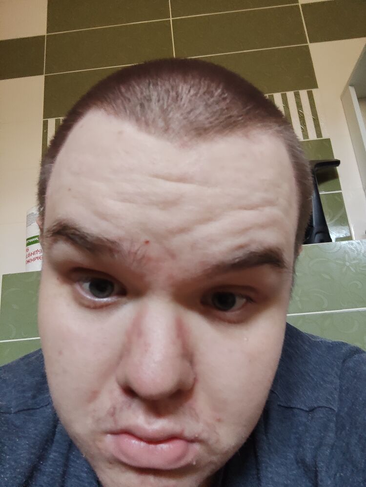  44545538  , 21 ,    Deleted