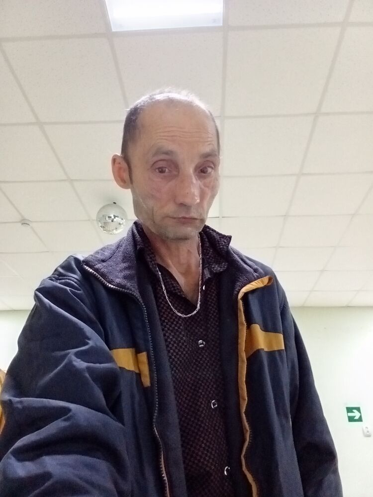  47281288  , 54 ,    --