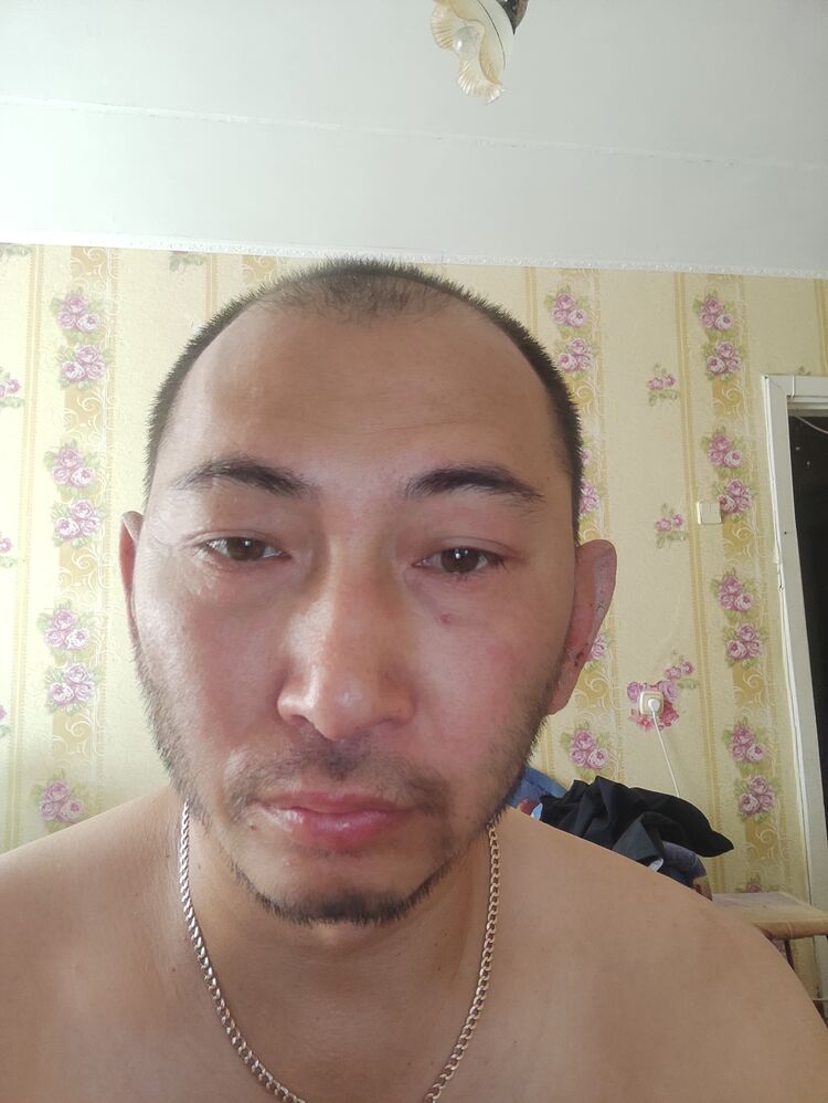  28166718  , 44 ,    