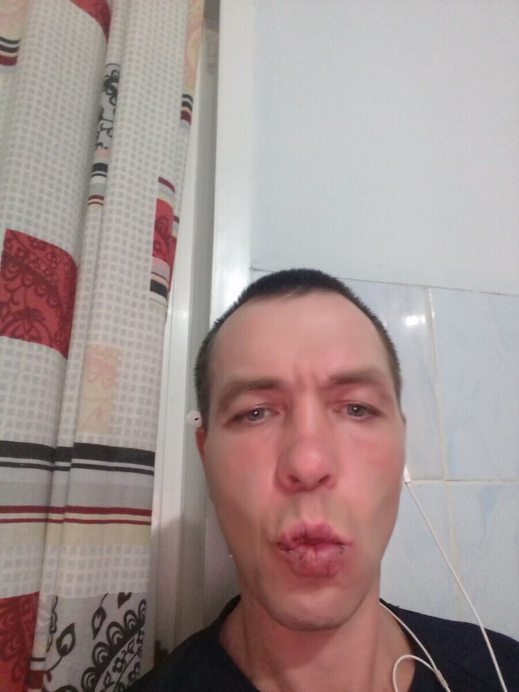  21958828  Artem, 41 ,    