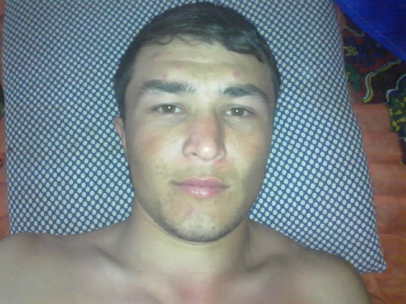  -,   ASAN, 35 ,   