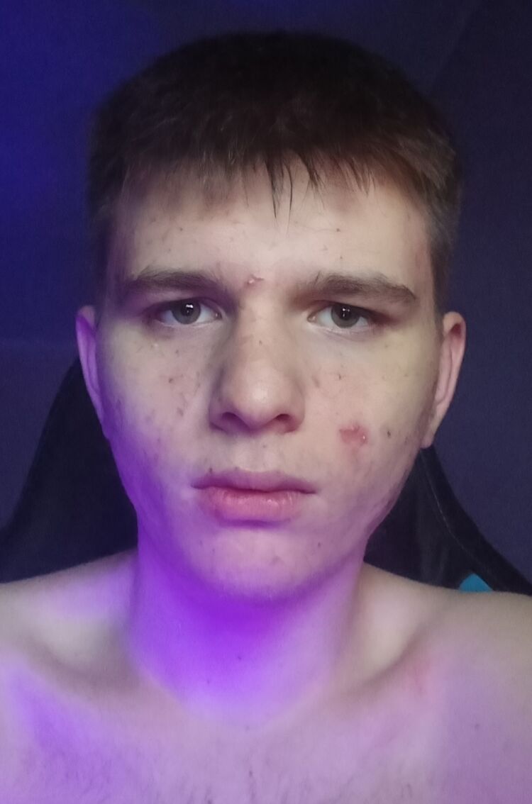  54204578  , 18 ,    -