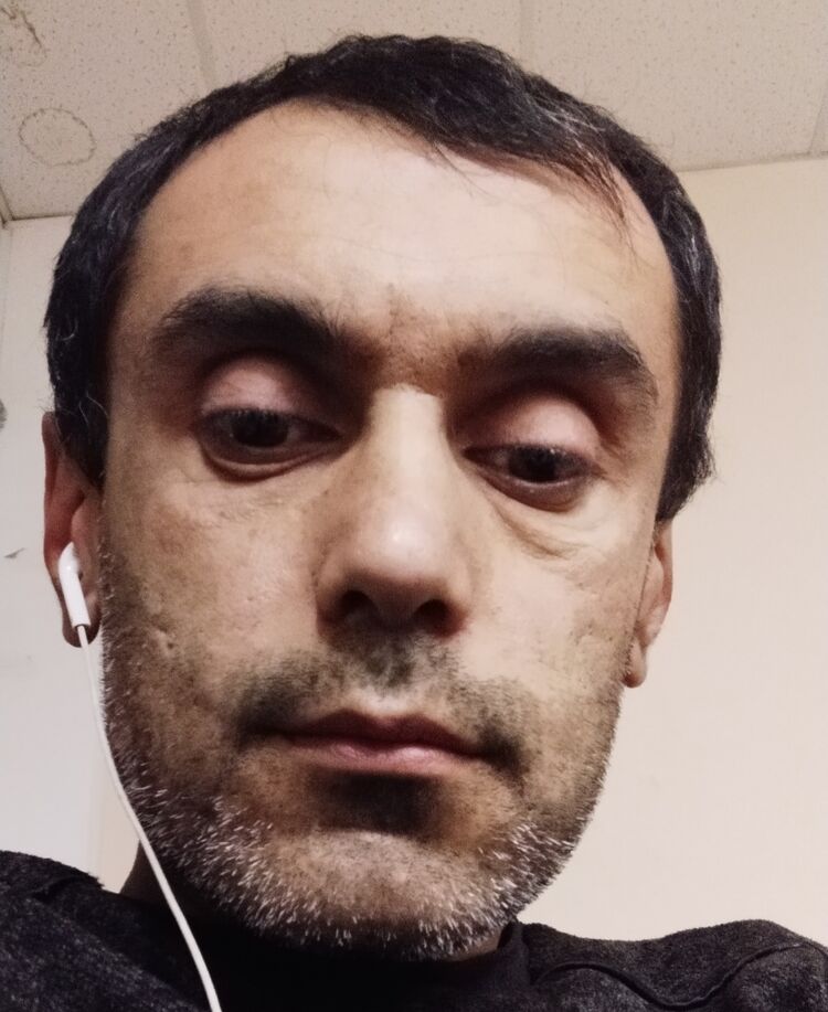  24140728  , 44 ,    