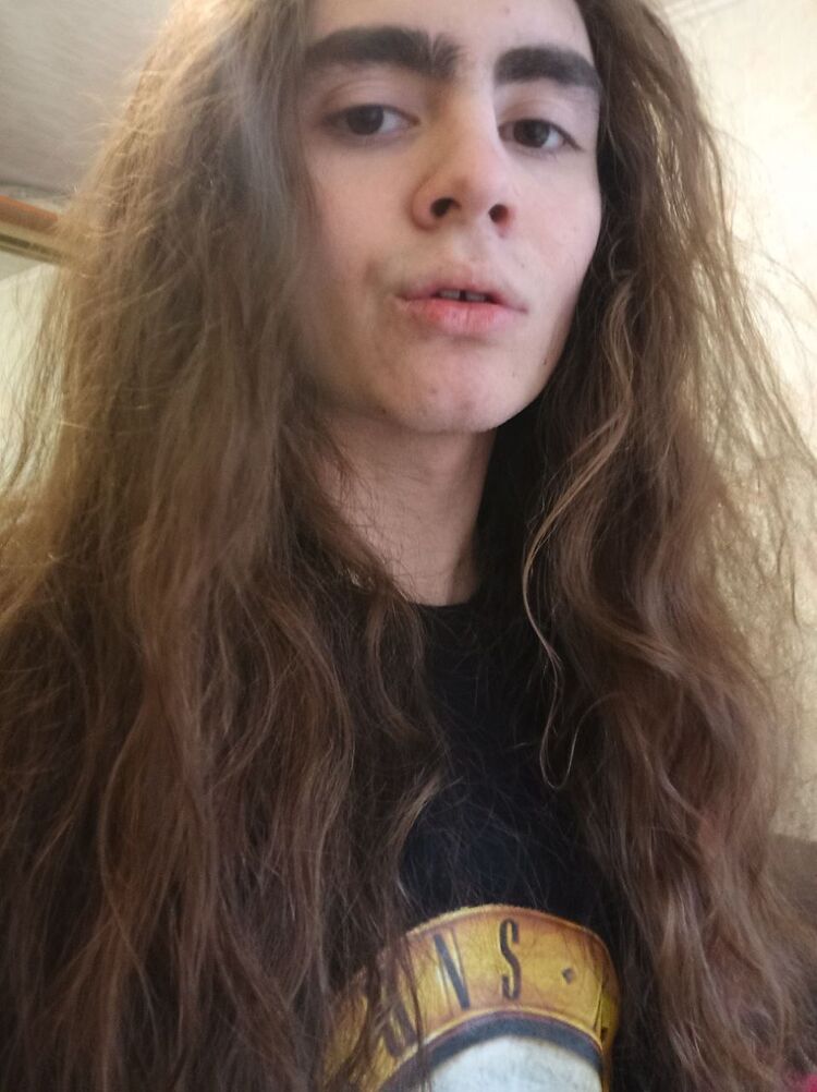 ���� 42952568 ����� Akne, 25 ���, ���� ���������� � ����������