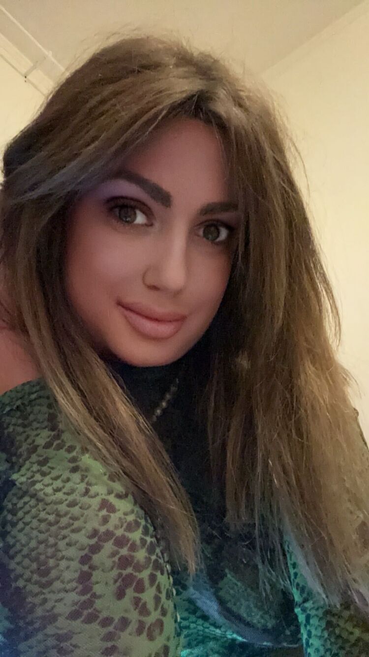 ���������� �����-���������, ���� ������� �����, 35 ���, ������������ 