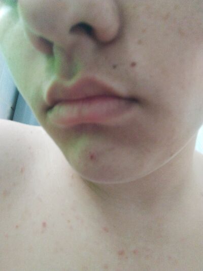  ,   Anton, 19 ,   ,   