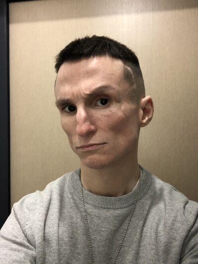  -,   , 33 ,   ,   