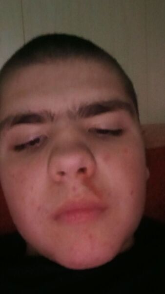  Butare,   , 18 ,   ,   